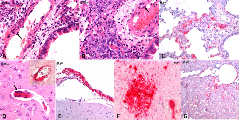 Nipah virus infection: preparedness for the pathological diagnosis of an emerging Paramyxoviridae disease with epidemic potential.