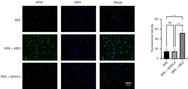 Effect of myeloid-derived suppressor cells on retinal epithelial cells in retinopathy of prematurity model.