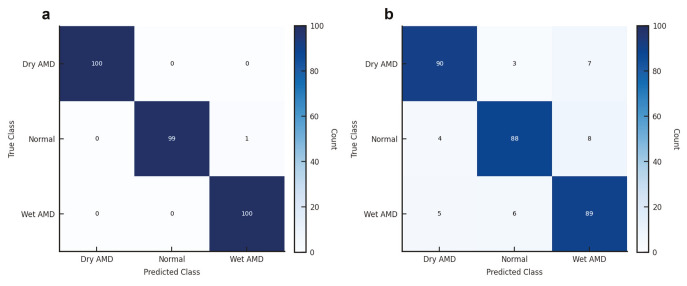 Comparative Analysis of Automated vs. Expert-Designed Machine Learning Models in Age-Related Macular Degeneration Detection and Classification.
