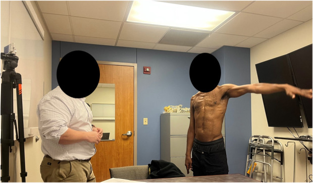 Accuracy and Reliability of Video-Based Range-of-Motion Assessments in Postreconstruction Brachial Plexus Patients.