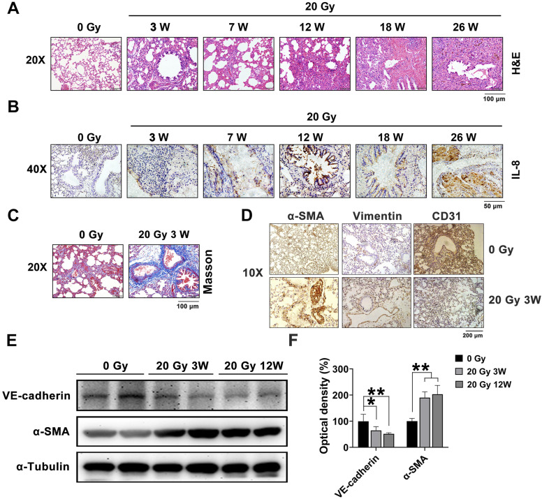 NEDD4-Mediated Endothelial-Mesenchymal Transition Participates in Radiation-Induced Lung Injury Through the ATM Signaling Pathway.