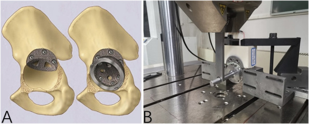 Interfacial Strength Between Porous Metal Acetabular Components and Augments.