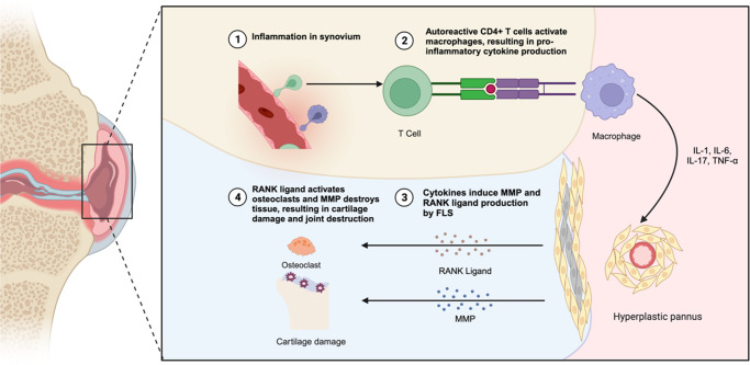 Unveiling the Therapeutic Potential: Targeting Fibroblast-like Synoviocytes in Rheumatoid Arthritis.