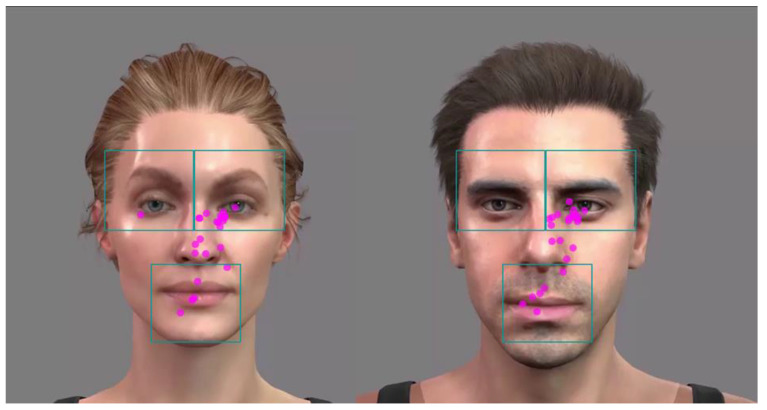 Audiovisual Perception of Sentence Stress in Cochlear Implant Recipients.