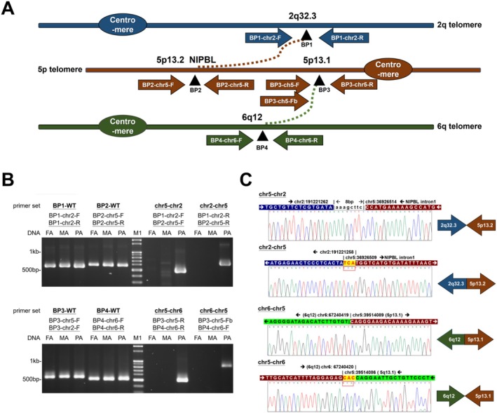 Identification of De Novo Chromosomal Translocations Disrupting NIPBL in a Patient With Cornelia de Lange Syndrome by Full Genome Analysis.