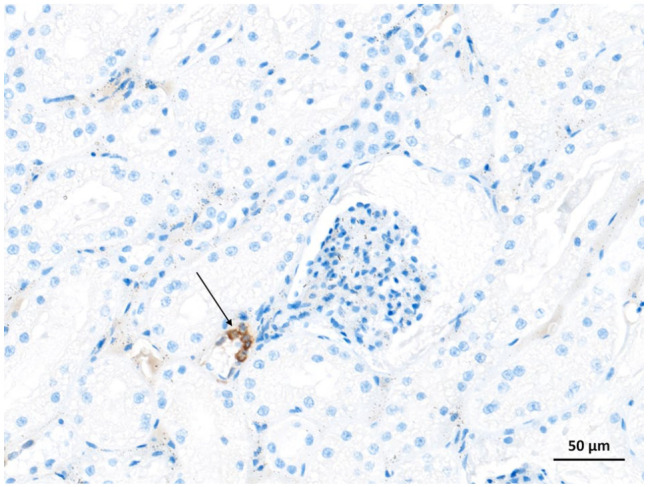 Immunohistochemical evaluation of cyclooxygenase-2 expression in feline nasal malignant epithelial tumours.