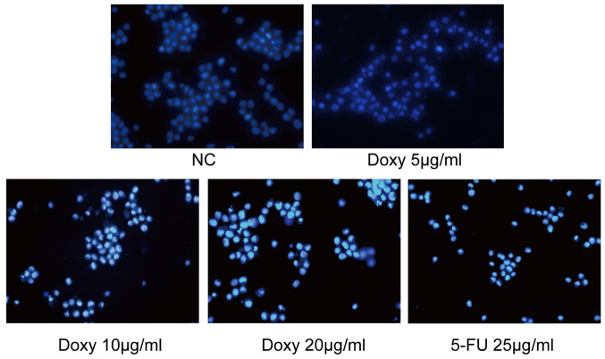 [Corrigendum] New application of an old drug: Antitumor activity and mechanisms of doxycycline in small cell lung cancer.