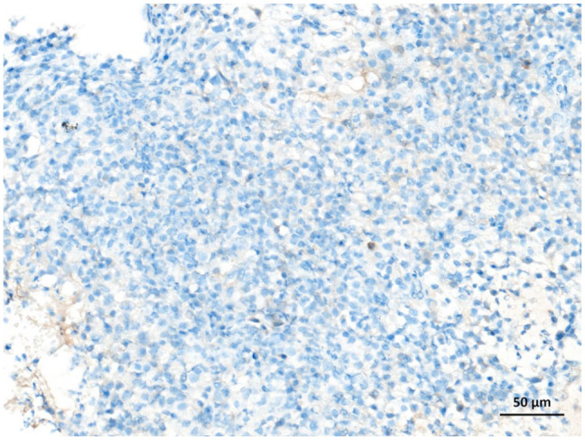 Immunohistochemical evaluation of cyclooxygenase-2 expression in feline nasal malignant epithelial tumours.