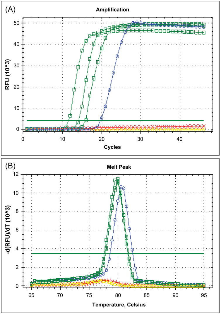 An alternative real-time fluorescence reverse transcription loop-mediated isothermal amplification assay for the rapid detection of SARS-CoV-2.