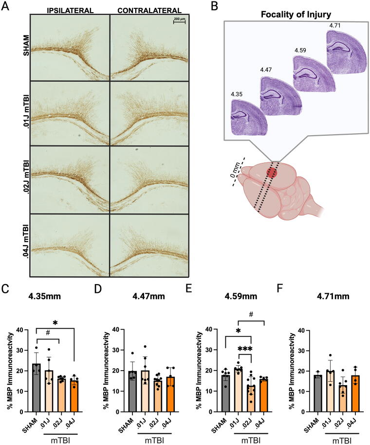 Early-Life Mild Traumatic Brain Injury Alters Neurodevelopment and Behavior in Mice.