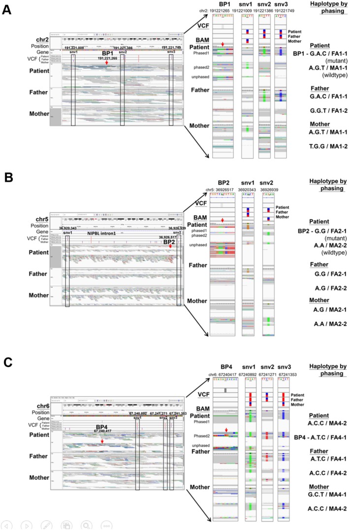 Identification of De Novo Chromosomal Translocations Disrupting NIPBL in a Patient With Cornelia de Lange Syndrome by Full Genome Analysis.