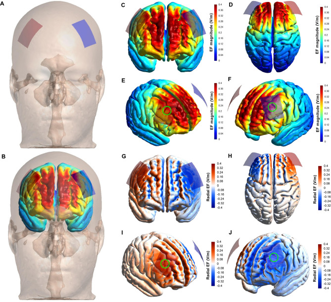 Multisession transcranial direct current stimulation and aerobic exercise synergistically improve food craving symptoms, impulsivity, and cognitive flexibility in women with overweight and obesity: a randomized controlled trial.