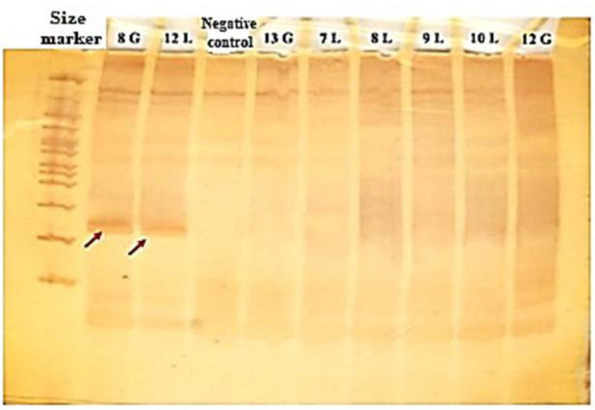 In vitro effects of purified lacticin from whey isolated <i>Lactococcus lactis</i> culture on <i>Staphylococcus aureus</i> and MCF-7 breast cancer cells.