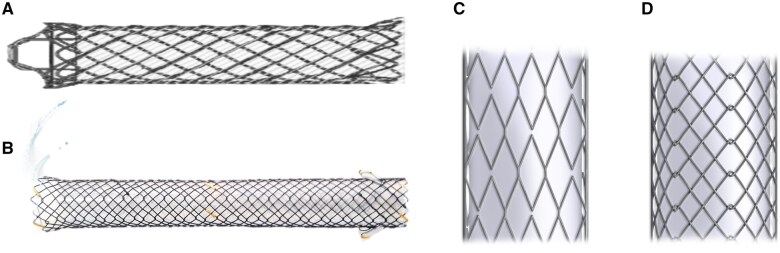 Prevention of stent migration of covered self-expandable metal stents in distal malignant biliary obstruction: a review of literature.
