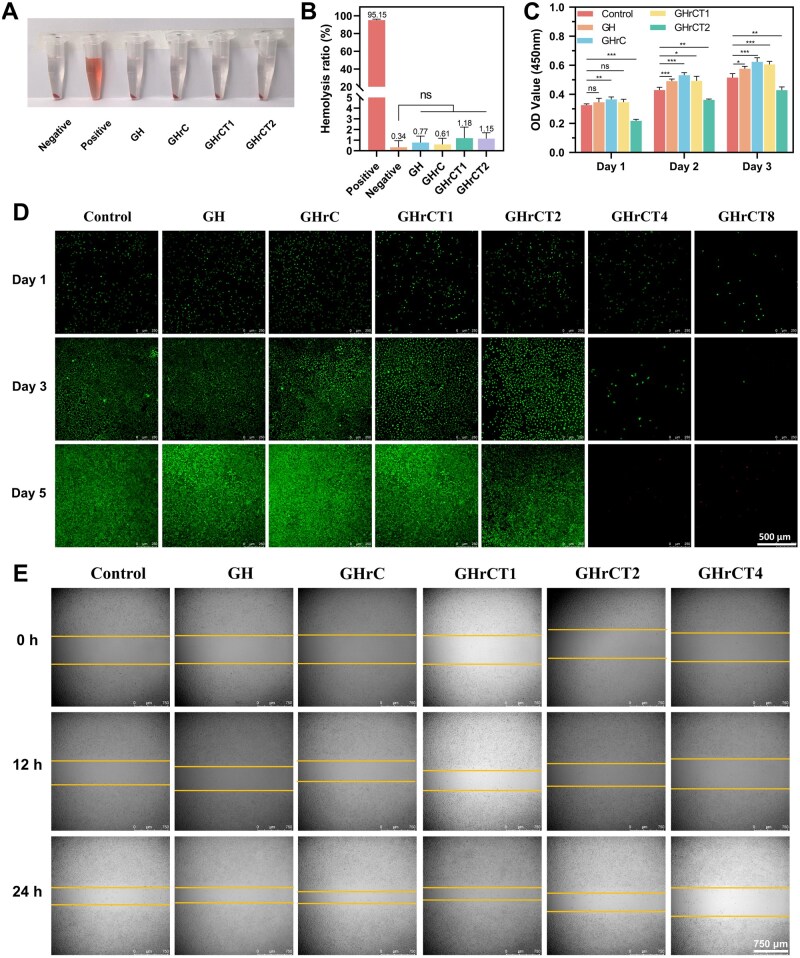 Gelatin/hyaluronic acid-based <i>in situ</i> forming hydrogel promotes wound regeneration by the synergy of ROS-scavenging and pro-healing activity.