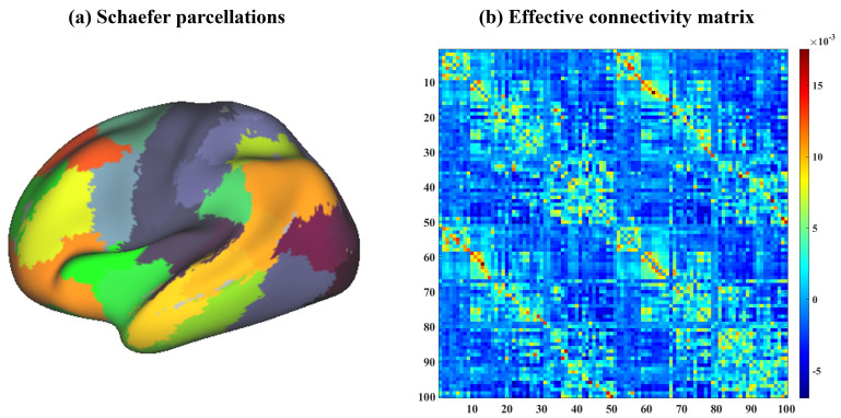 Network Specificity in Predicting Childhood Trauma Characteristics Using Effective Connectivity.