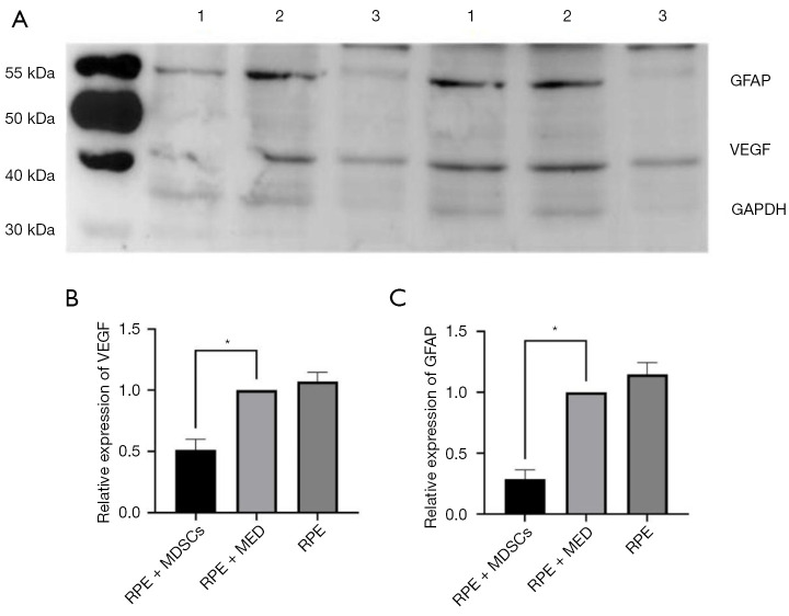 Effect of myeloid-derived suppressor cells on retinal epithelial cells in retinopathy of prematurity model.