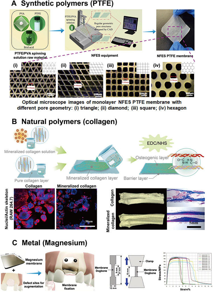 Implantable Dental Barrier Membranes as Regenerative Medicine in Dentistry: A Comprehensive Review.