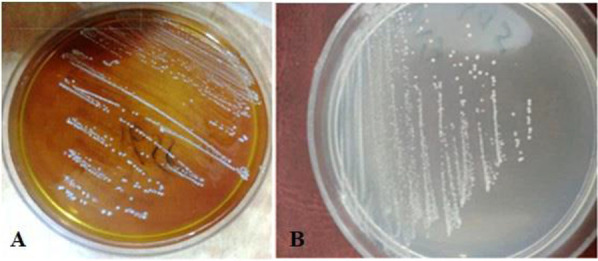 Effects of lactic acid bacteria isolated from dairy products on lipid pattern of rats fed with a high fat diet.