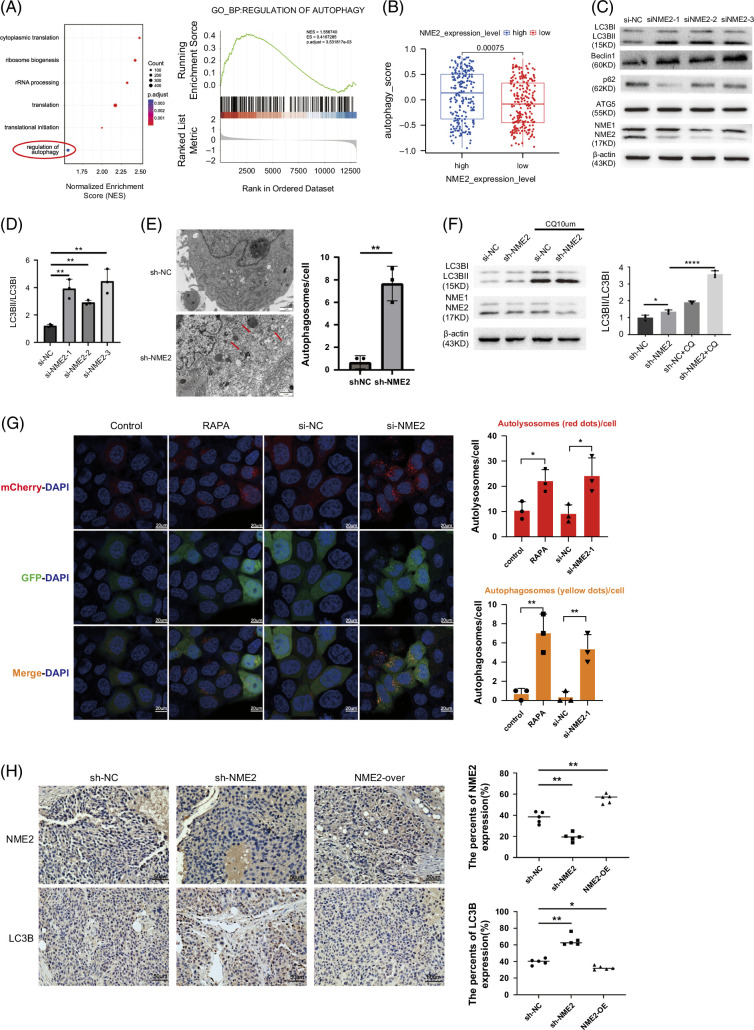NME2 modulates HCC progression through 4EBP1 phosphorylation and autophagy regulation independent of mTOR.