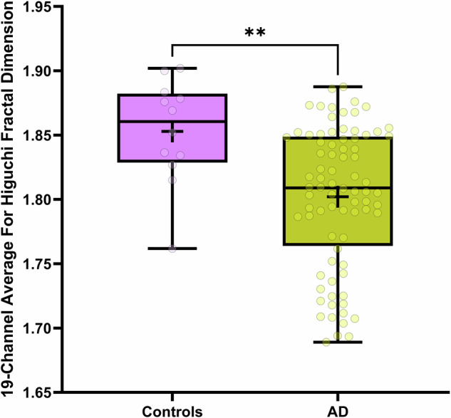 Evaluating EEG complexity and spectral signatures in Alzheimer's disease and frontotemporal dementia: evidence for rostrocaudal asymmetry.