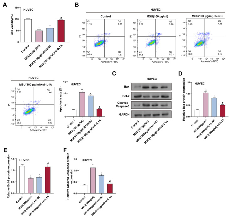 <i>IL1A</i> regulates MSU-induced apoptosis and inflammatory response through TLR4/MyD88/NF-κB signaling pathway.