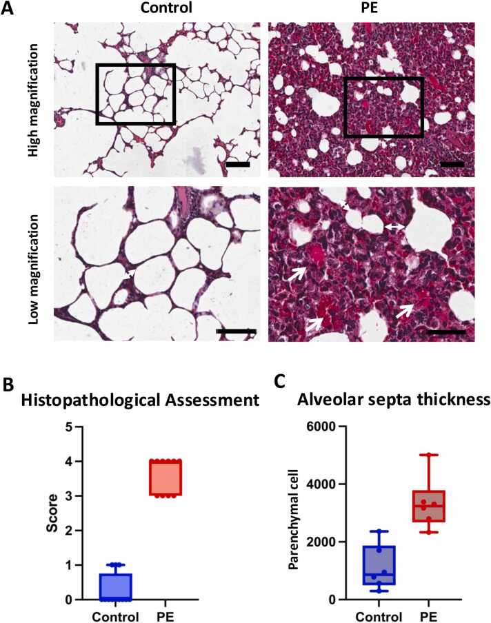 Sub-acute polyethylene microplastic inhalation exposure induced pulmonary toxicity in wistar rats through inflammation and oxidative stress.