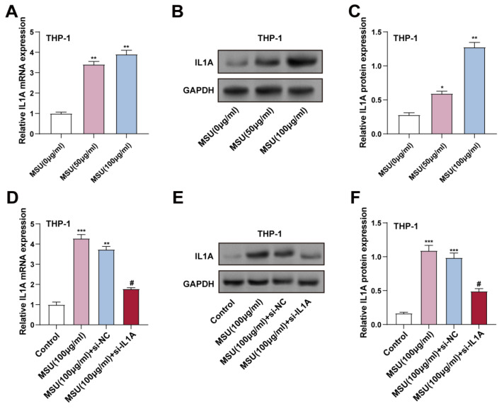 <i>IL1A</i> regulates MSU-induced apoptosis and inflammatory response through TLR4/MyD88/NF-κB signaling pathway.