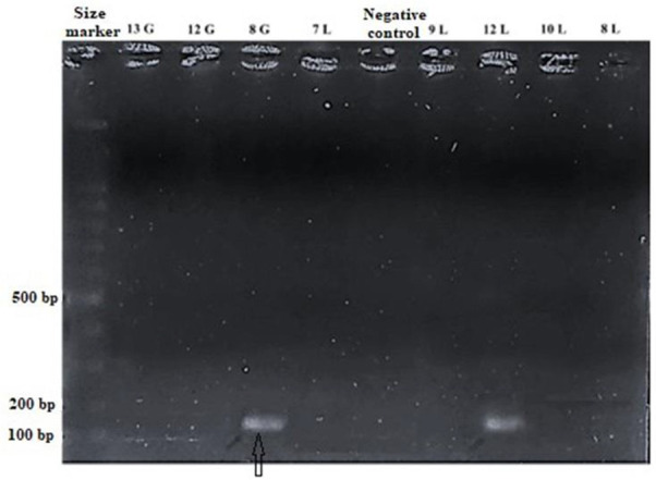 In vitro effects of purified lacticin from whey isolated <i>Lactococcus lactis</i> culture on <i>Staphylococcus aureus</i> and MCF-7 breast cancer cells.