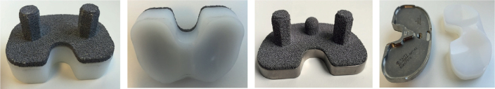 Long-term migration of monoblock vs modular design in uncemented total knee arthroplasty: a secondary report of a randomized trial using radiostereometric analysis.