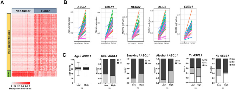 Salivary cell-free DNA methylation analysis for oncological monitoring of surgical resection of oral squamous cell carcinoma.