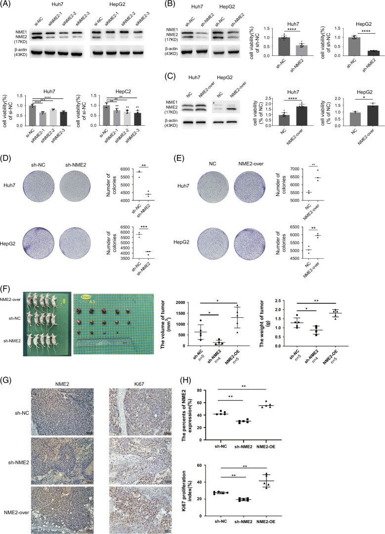 NME2 modulates HCC progression through 4EBP1 phosphorylation and autophagy regulation independent of mTOR.
