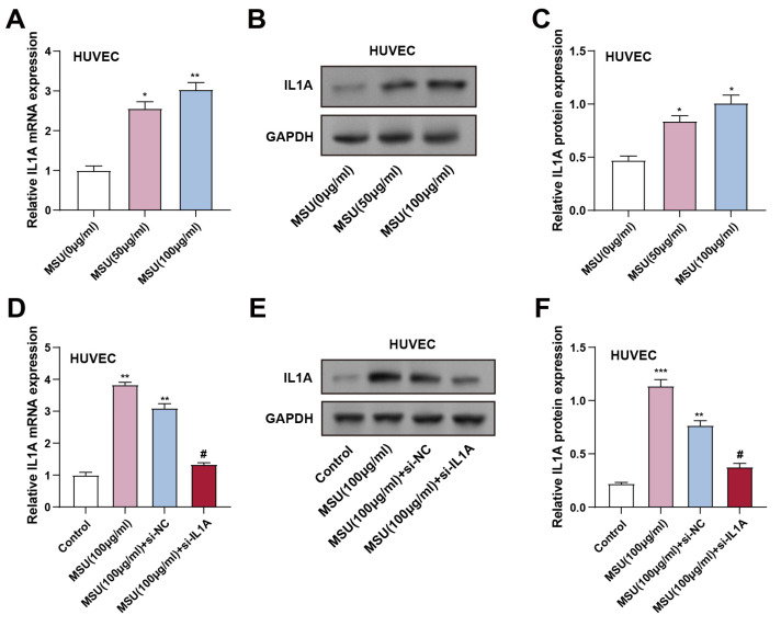 <i>IL1A</i> regulates MSU-induced apoptosis and inflammatory response through TLR4/MyD88/NF-κB signaling pathway.
