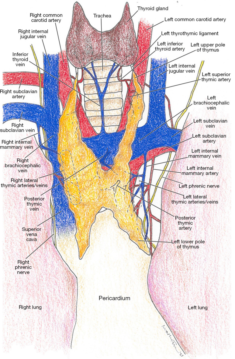 Intraoperative complications during robotic thymectomy and their management: a narrative review.