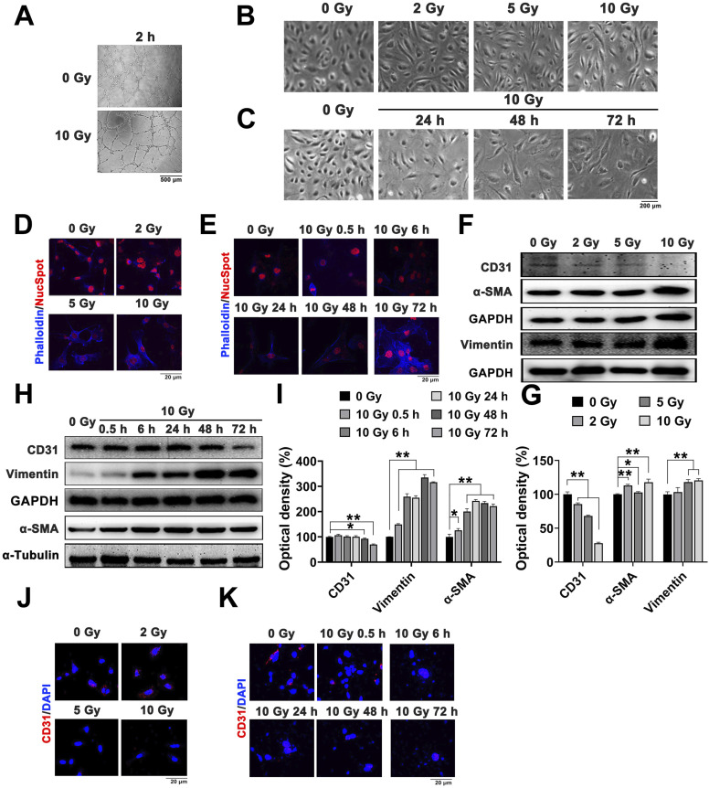 NEDD4-Mediated Endothelial-Mesenchymal Transition Participates in Radiation-Induced Lung Injury Through the ATM Signaling Pathway.