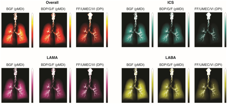 In Silico Lung Deposition Profiles of Three Single-Inhaler Triple Therapies in Patients with COPD Using Functional Respiratory Imaging.