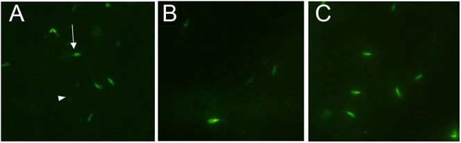 Incubation of semen with human follicular fluid improves the antioxidant status and quality of spermatozoa after freezing-thawing.