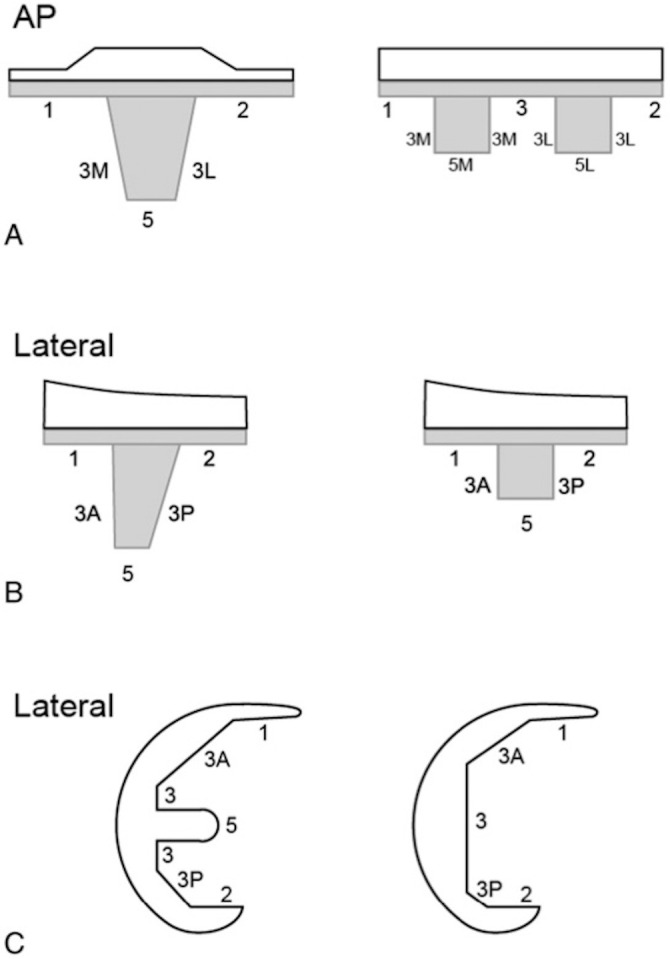 Comparative analysis of early radiolucencies in cementless versus cemented total knee arthroplasty.