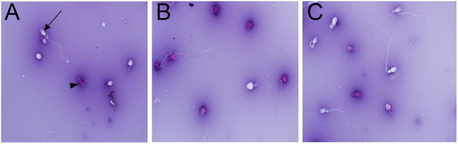 Incubation of semen with human follicular fluid improves the antioxidant status and quality of spermatozoa after freezing-thawing.