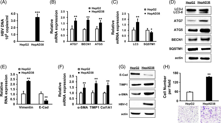 HBV promotes epithelial-mesenchymal transition in HCC and liver fibrosis through JNK-mediated autophagy.