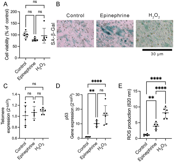 Stress-stimulated epinephrine induces premature senescence in dermal fibroblasts and contributes to impaired skin wound healing.
