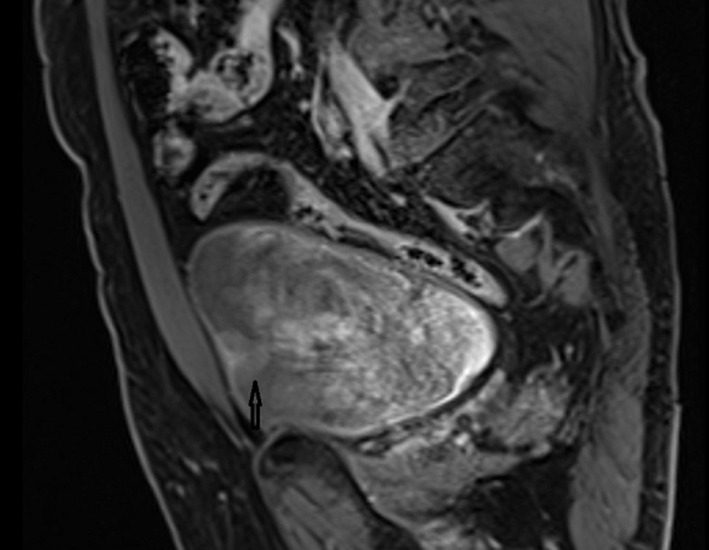 Long live the kidney despite every threats: a case report.