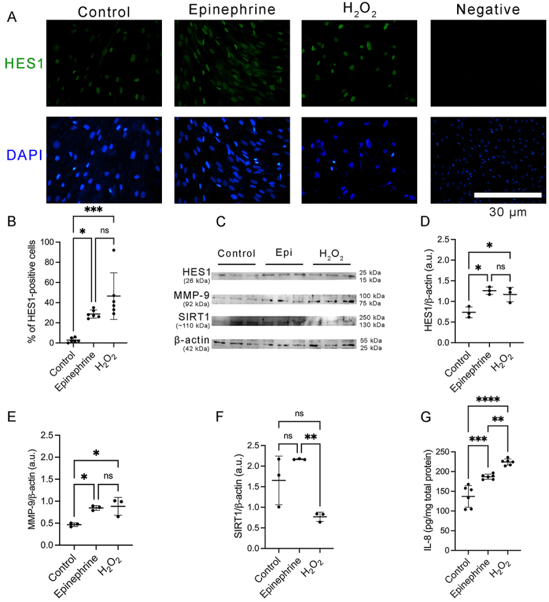 Stress-stimulated epinephrine induces premature senescence in dermal fibroblasts and contributes to impaired skin wound healing.