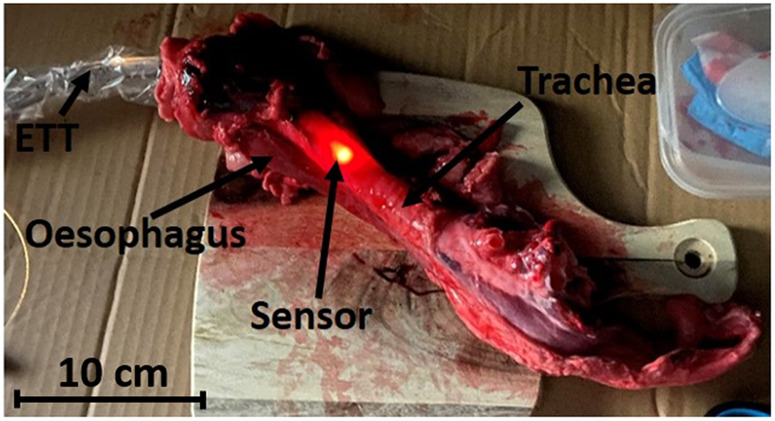 <i>Ex vivo</i> investigation of a smart endotracheal tube for identifying esophageal intubation.