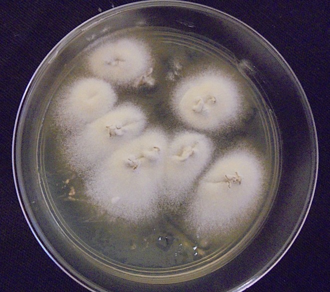Zoonotic and Anthropophilic Trichophyton mentagrophytes Complex Infection in Human: An Update and Narrative Review.