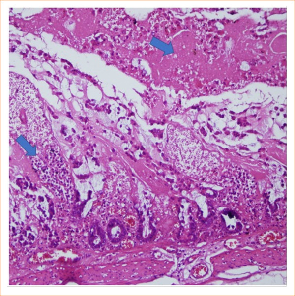 Protective role of pinocembrin in a rat model of intestinal ischemia-reperfusion injury.