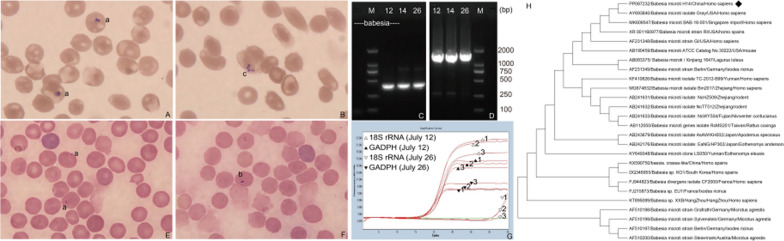 Babesia microti (Babesiidae, Piroplasmida) infection in a Chinese traveler returning from the United States of America.