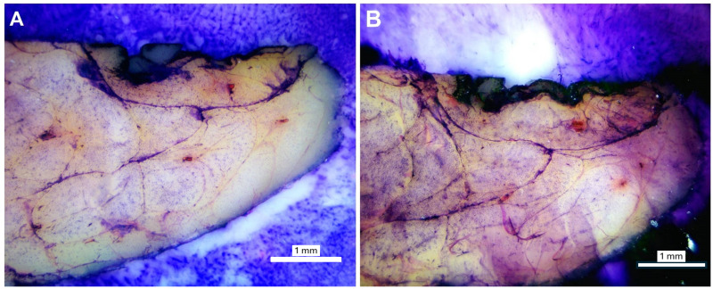 Development of an H&E on-block staining technique for collagen detection in cryo-fluorescence tomography imaging of frozen breast tissue samples.