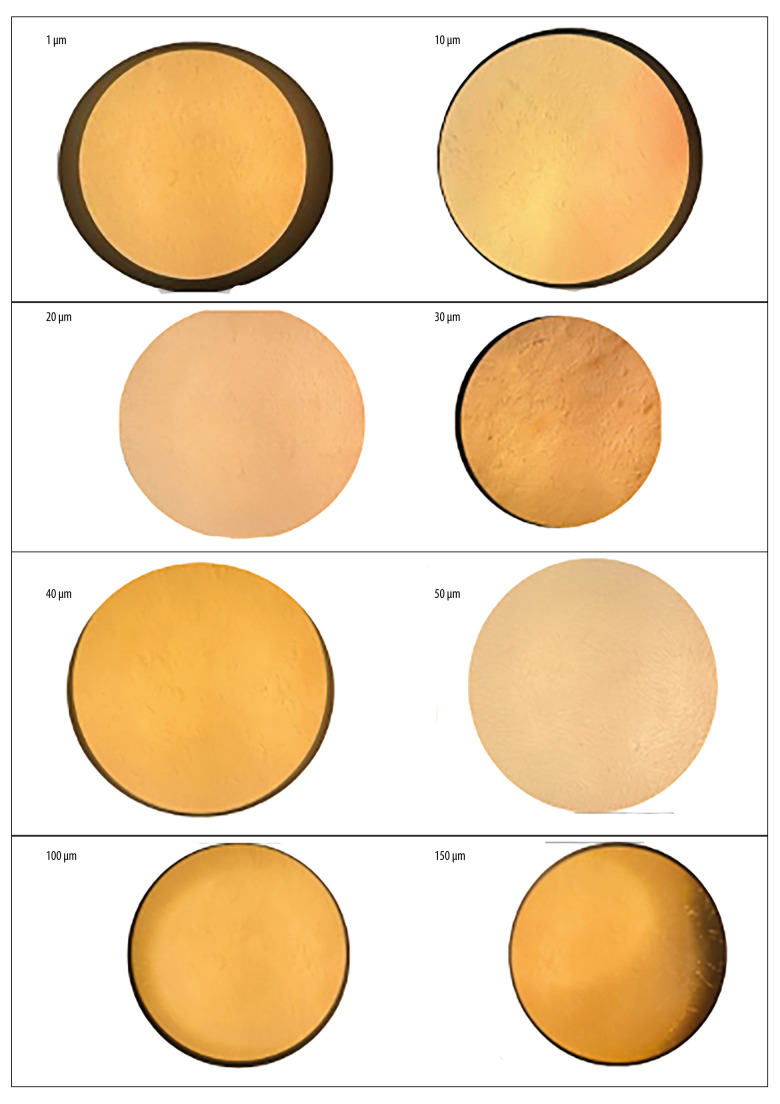 Efficacy of Different Concentrations of Melatonin on Cultured Human Periodontal Ligament Stem Cells.