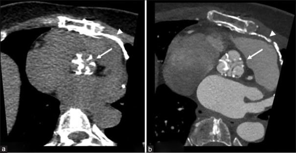 Clinics in diagnostic imaging (223).